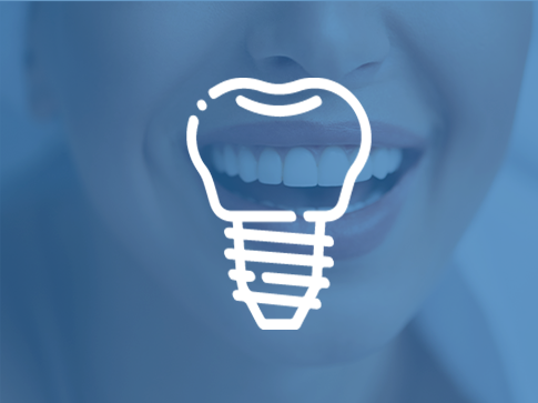 Zirconia Treatment